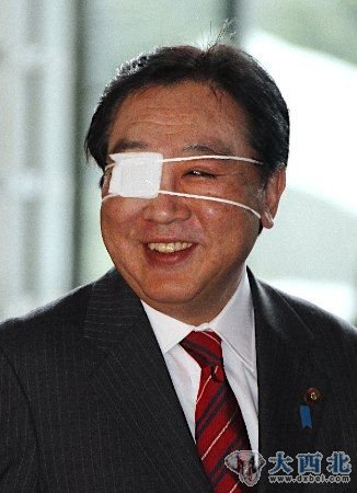 日本首相野田佳彥當?shù)貢r間16日出現(xiàn)在記者們面前，眼部包著紗布，成了“獨眼龍”